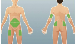 胰岛素注射方法视频,视频教程助您轻松掌握